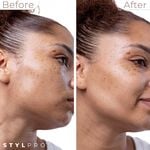 Stylpro 2-in-1 Sonic Dermaplaner