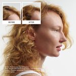 Nioxin System 1 Pro Clinical Testset