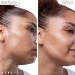 Stylpro 2-in-1 Sonic Dermaplaner