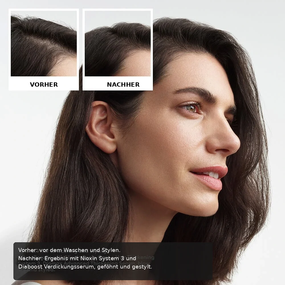 Nioxin System Trial Kit 3 before and after image