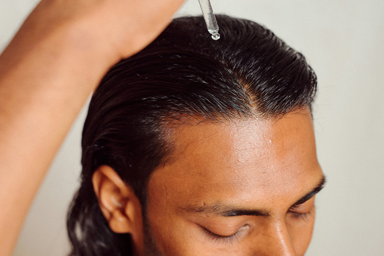 Empfindliche Kopfhaut